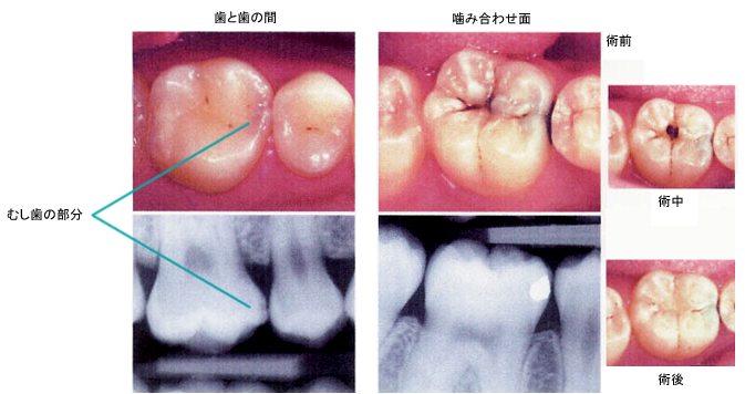 病態画像