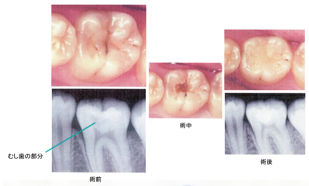病態画像