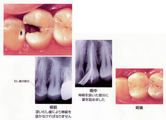 病態画像