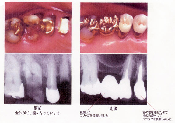 病態画像