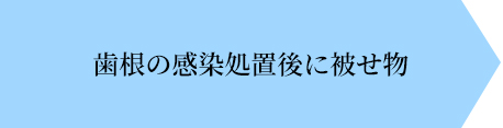 詰め物画像